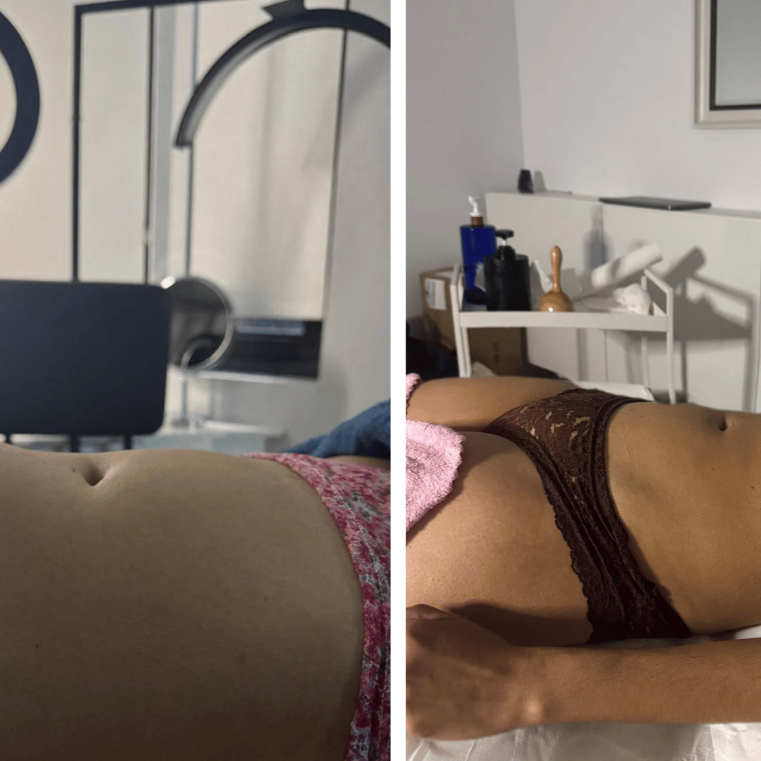 4-in-1 Signature Massage - Therapeutic