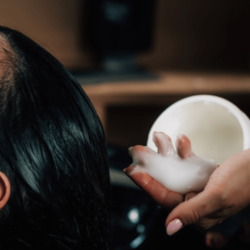 Hair loss treatment